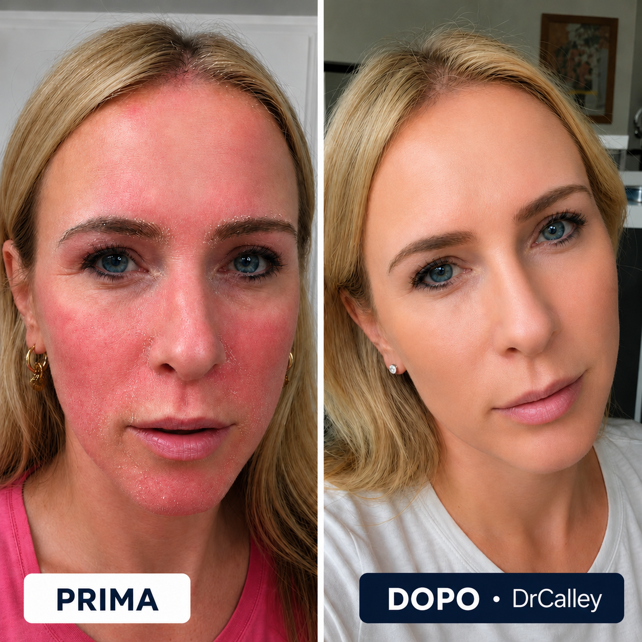 DRCALLEY – Crema Lenitiva e Rigenerante