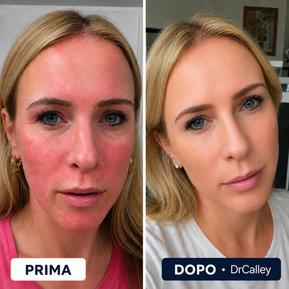 DRCALLEY – Crema Lenitiva e Rigenerante