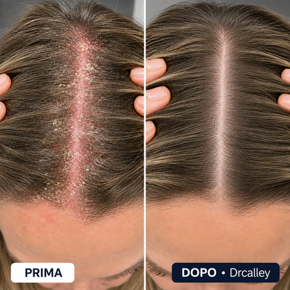 DRCALLEY – Crema Lenitiva e Rigenerante